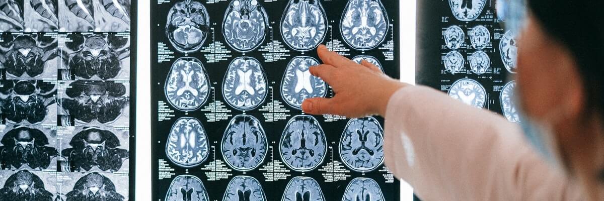 brain scan of an incapacitated victim